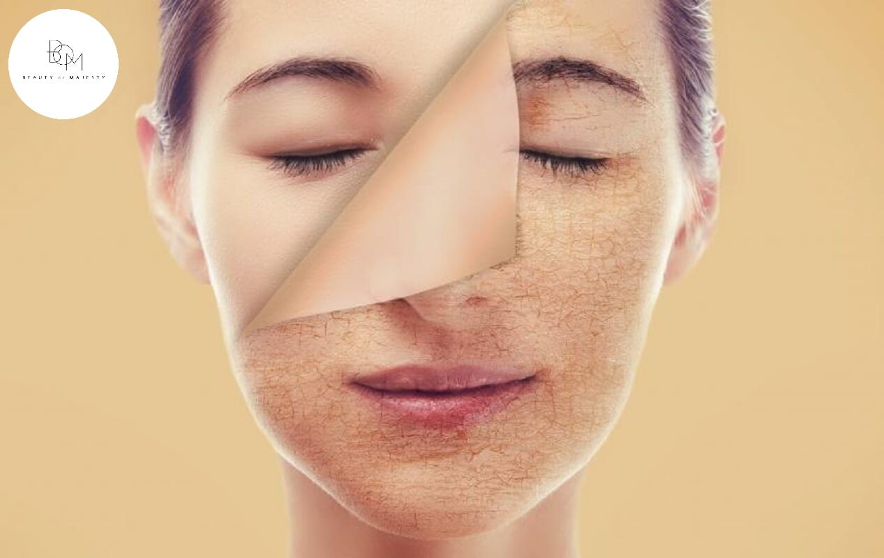 Loại da khô là loại da có tuyến bã nhờn hoạt động yếu, do đó không cung cấp đủ lượng độ ẩm cần thiết cho da. Và da dễ dàng bị mất nước dẫn tới thường xuyên bị nứt nẻ, sần sùi, bong tróc.