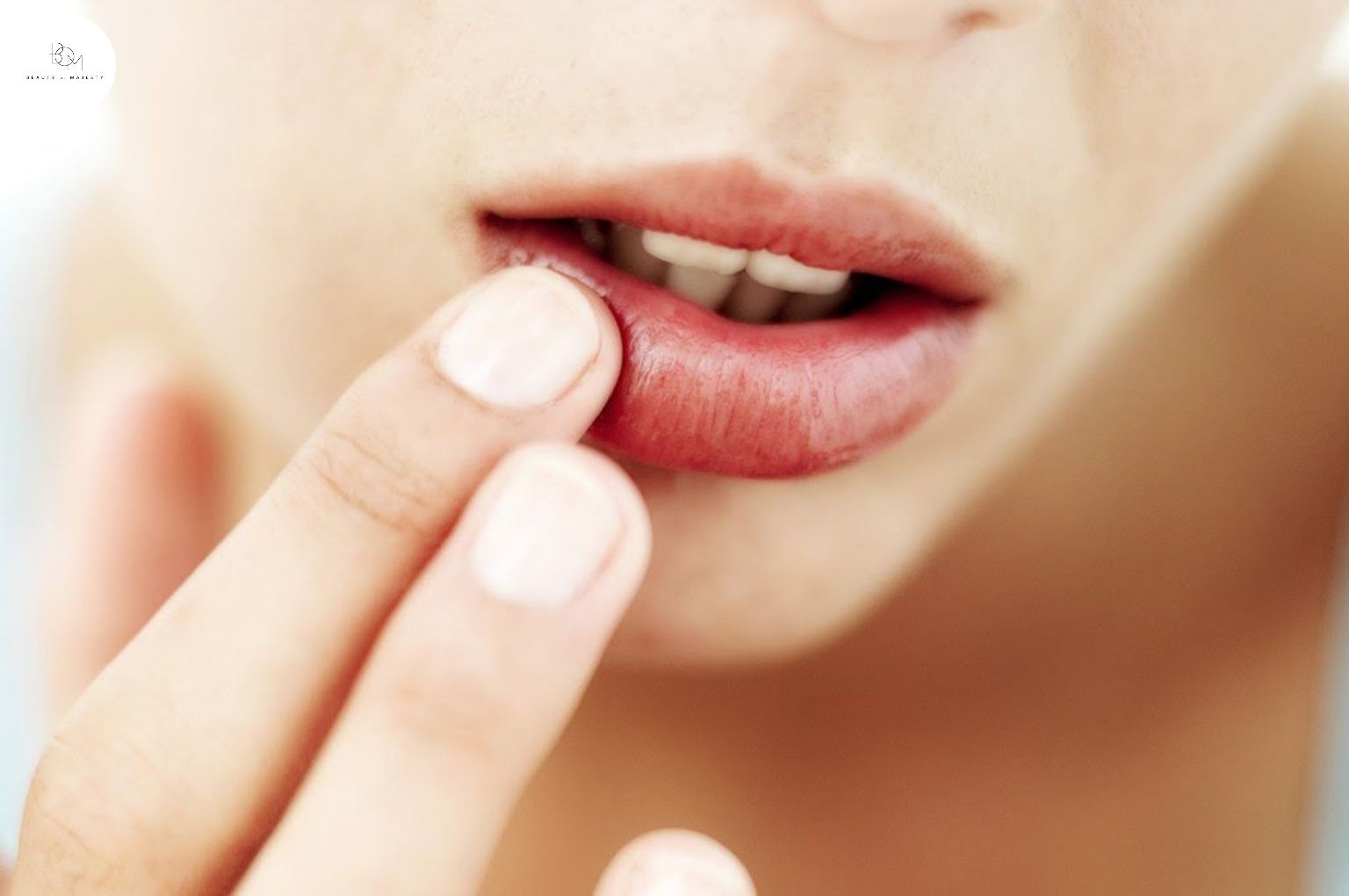 Làn da môi của bạn có dấu hiệu thương tổn khi sử dụng son fake